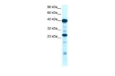 Western Blot: SIX6 Antibody [NBP2-83529] - WB Suggested Anti-SIX6 Antibody Titration: 0.2-1 ug/ml. Positive Control: Jurkat cell lysate