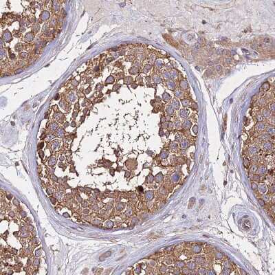 Immunohistochemistry-Paraffin: SKA1 Antibody [NBP1-92391] - Staining of human testis shows strong cytoplasmic positivity in cells in seminiferous ducts.