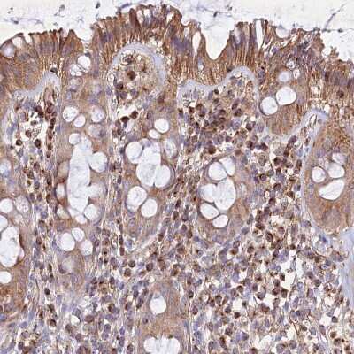 Immunohistochemistry-Paraffin: SKA1 Antibody [NBP1-92391] - Staining of human rectum shows moderate cytoplasmic positivity in lymphoid cells.