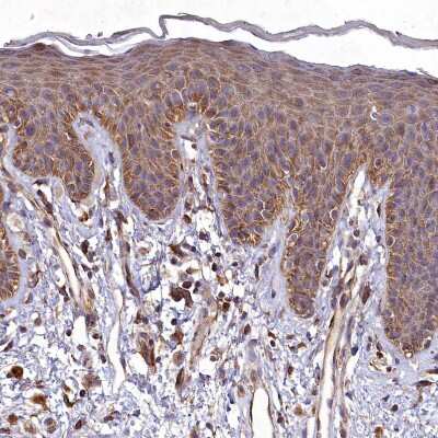 Immunohistochemistry-Paraffin: SKA1 Antibody [NBP1-92391] - Staining of human skin shows moderate cytoplasmic positivity in squamous epithelial cells.