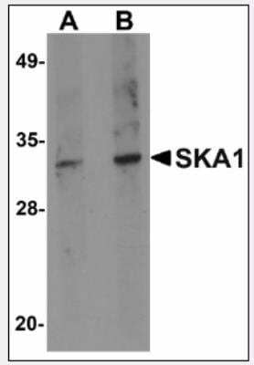 Western Blot: SKA1 Antibody [NBP1-72131] - SKA1 in A549 cell lysate with SKA1 antibody at (A) 0.5 and (B) 1 ug/ml.