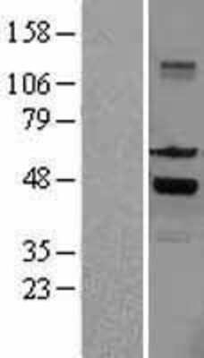 Western Blot: SKAP55 Overexpression Lysate (Adult Normal) [NBL1-15986] Left-Empty vector transfected control cell lysate (HEK293 cell lysate); Right -Over-expression Lysate for SKAP55.