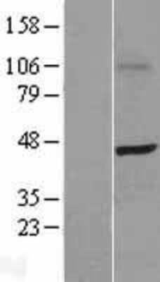 Western Blot: SKAP55 Overexpression Lysate (Adult Normal) [NBL1-15987] Left-Empty vector transfected control cell lysate (HEK293 cell lysate); Right -Over-expression Lysate for SKAP55.