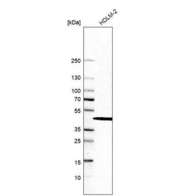 Western Blot: SKIP Antibody [NBP1-87034] - Analysis in human cell line HDLM-2.