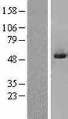 Western Blot: SKIP Overexpression Lysate (Adult Normal) [NBL1-15991] Left-Empty vector transfected control cell lysate (HEK293 cell lysate); Right -Over-expression Lysate for SKIP.