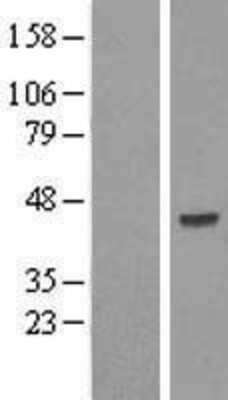 Western Blot: SKIP Overexpression Lysate (Adult Normal) [NBL1-15992] Left-Empty vector transfected control cell lysate (HEK293 cell lysate); Right -Over-expression Lysate for SKIP.