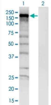 Western Blot: SKIV2L Antibody (1E5) [H00006499-M05-50ug] - Analysis of SKIV2L expression in transfected 293T cell line by SKIV2L monoclonal antibody (M05), clone 1E5.  Lane 1: SKIV2L transfected lysate (Predicted MW: 137.06 KDa). Lane 2: Non-transfected lysate.