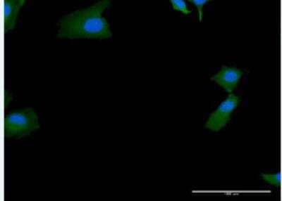 Immunocytochemistry/Immunofluorescence: SKIV2L Antibody [H00006499-B01P-50ug] -  Purified MaxPab antibody to SKIV2L on HeLa cell. [antibody concentration 30 ug/ml]