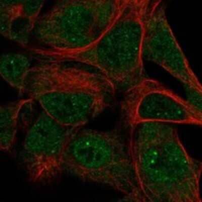 Immunocytochemistry/Immunofluorescence: SKIV2L Antibody [NBP3-17769] - Staining of human cell line HEK 293 shows localization to nucleoplasm & nuclear bodies.