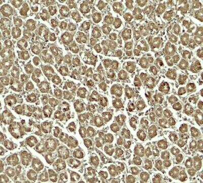 Immunohistochemistry SKIV2L Antibody - BSA Free