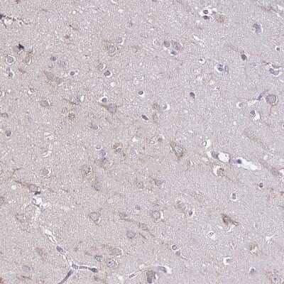 Immunohistochemistry-Paraffin: SKIV2L Antibody [NBP2-47275] - Staining of human cerebral cortex shows no cytoplasmic positivity in neuronal cells.