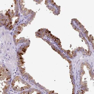 Immunohistochemistry-Paraffin: SKIV2L Antibody [NBP2-47275] - Staining of human prostate shows moderate cytoplasmic positivity in glandular cells.