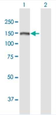 Western Blot: SKIV2L Antibody [H00006499-B01P-50ug] - Analysis of SKIV2L expression in transfected 293T cell line (H00006499-T01) by SKIV2L MaxPab polyclonal antibody.  Lane 1: SKIV2L transfected lysate(137.06 KDa). Lane 2: Non-transfected lysate