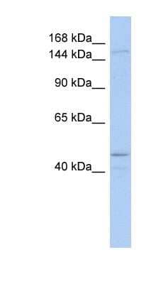 Western Blot: SKIV2L Antibody [NBP1-57119] - Titration: 0.2-1 ug/ml, Positive Control: COLO205 cell lysate.