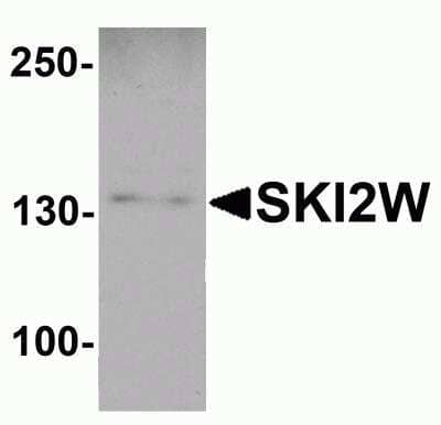 Western Blot SKIV2L Antibody - BSA Free