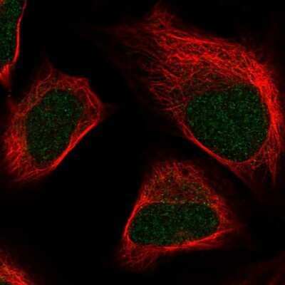 Immunocytochemistry/Immunofluorescence: SKIV2L2 Antibody [NBP1-84995] - Staining of human cell line U-2 OS shows positivity in nucleus. Antibody staining is shown in green.