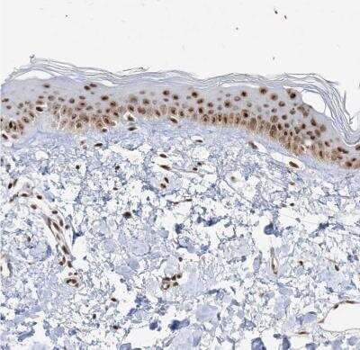 Immunohistochemistry-Paraffin: SKIV2L2 Antibody [NBP1-84995] -  Staining of human skin shows moderate nuclear positivity in epidermal cells.