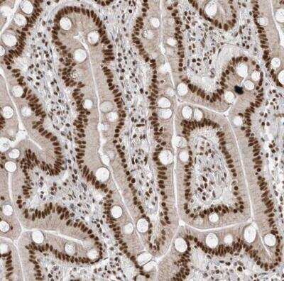 Immunohistochemistry-Paraffin: SKIV2L2 Antibody [NBP1-84995] - Staining of human duodenum shows moderate nuclear positivity in glandular cells.