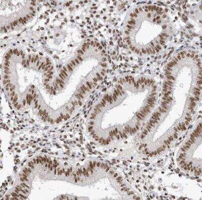 Immunohistochemistry-Paraffin: SKIV2L2 Antibody [NBP1-84995] - Staining of human endometrium shows moderate nuclear positivity in glandular cells.