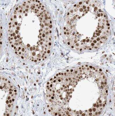 Immunohistochemistry-Paraffin: SKIV2L2 Antibody [NBP1-84995] -  Staining of human testis shows moderate nuclear positivity in cells in seminiferous ducts.