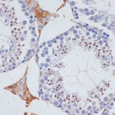 Immunohistochemistry-Paraffin: SKIV2L2 Antibody [NBP2-94315] - Mouse testis using SKIV2L2 antibody at dilution of 1:100 (40x lens).