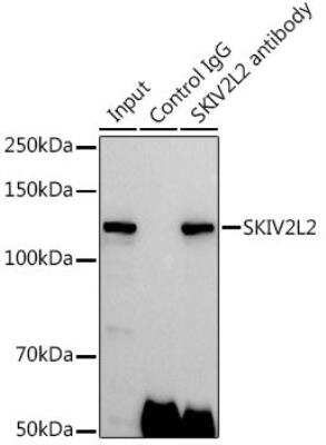 Immunoprecipitation: SKIV2L2 Antibody [NBP2-94315] - Analysis of 300ug extracts of 293T cells using 3ug SKIV2L2 antibody.  Western blot was performed from the immunoprecipitate using SKIV2L2 antibody at a dilition of 1:500.