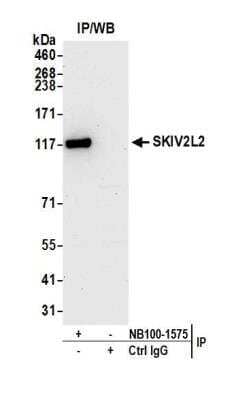 Unknown SKIV2L2 Antibody