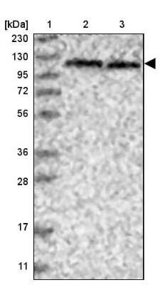 Western Blot: SKIV2L2 Antibody [NBP1-84995] - Lane 1: Marker  [kDa] 230, 130, 95, 72, 56, 36, 28, 17, 11.  Lane 2: Human cell line RT-4.  Lane 3: Human cell line U-251MG sp