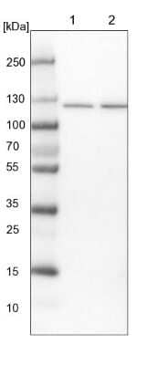 Western Blot SKIV2L2 Antibody