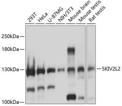 Western Blot: SKIV2L2 Antibody [NBP2-93932] - Analysis of extracts of various cell lines, using SKIV2L2 at 1:3000 dilution. Secondary antibody: HRP Goat Anti-Rabbit IgG (H+L) at 1:10000 dilution. Lysates/proteins: 25ug per lane. Blocking buffer: 3% nonfat dry milk in TBST. Detection: ECL Basic Kit . Exposure time: 1s.