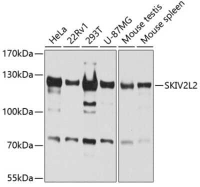 Western Blot: SKIV2L2 Antibody [NBP2-94315] - Analysis of extracts of various cell lines, using SKIV2L2 at 1:1000 dilution. Secondary antibody: HRP Goat Anti-Rabbit IgG (H+L) at 1:10000 dilution. Lysates/proteins: 25ug per lane. Blocking buffer: 3% nonfat dry milk in TBST. Detection: ECL Basic Kit . Exposure time: 60s.