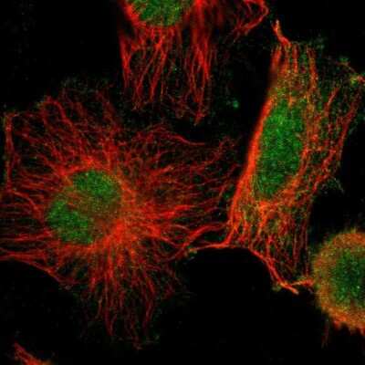 Immunocytochemistry/ Immunofluorescence SKT Antibody