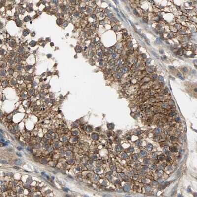 Immunohistochemistry-Paraffin: SKT Antibody [NBP1-84100] - Staining of human testis shows moderate cytoplasmic and membranous positivity in cells in seminiferous ducts.