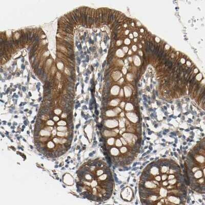 Immunohistochemistry-Paraffin: SKT Antibody [NBP1-84100] - Staining of human colon shows moderate cytoplasmic and membranous positivity in glandular cells.