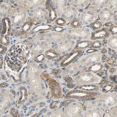 Immunohistochemistry-Paraffin: SKT Antibody [NBP1-84100] - Staining of human kidney shows moderate cytoplasmic and membranous positivity in cells in distal tubules.