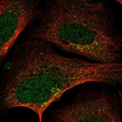 Immunocytochemistry/Immunofluorescence: SLA2 Antibody [NBP2-55334] - Staining of human cell line U-2 OS shows localization to nucleoplasm, the Golgi apparatus & vesicles.