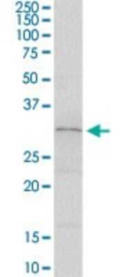 Western Blot: SLA2 Antibody [H00084174-D01P] - Analysis of SLA2 expression in human colon.