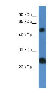 Western Blot: SLA2 Antibody [NBP1-79829] - Jurkat cell lysate, concentration 0.2-1 ug/ml.