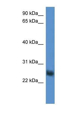 Western Blot: SLA2 Antibody [NBP1-79830] - HepG2 cell lysate, concentration 0.2-1 ug/ml.