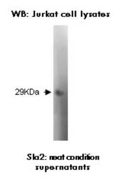 Western Blot: SLA2 Antibody (Z30P1F12/F4) [NBP2-50293] - Analysis of SLA2 in transfected Jurkat cell lysate.