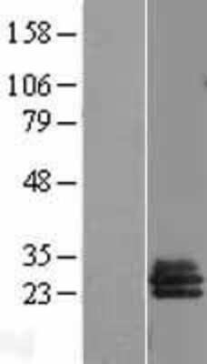 Western Blot: SLA2 Overexpression Lysate (Adult Normal) [NBL1-15998] Left-Empty vector transfected control cell lysate (HEK293 cell lysate); Right -Over-expression Lysate for SLA2.