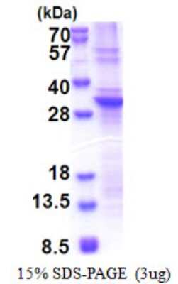 SDS-Page: SLA2 Protein [NBP2-22823]