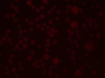 Immunocytochemistry/ Immunofluorescence SLAIN1 Antibody - BSA Free