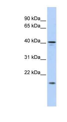 Western Blot: SLAIN1 Antibody [NBP1-70704] - Titration: 0.2-1 ug/ml, Positive Control: HepG2 cell lysate.