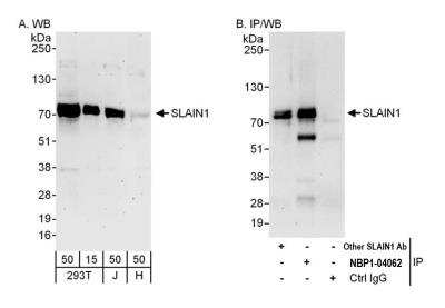 Western Blot: SLAIN1 Antibody [NBP2-04062] - Detection of human SLAIN1 by western blot and immunoprecipitation. Samples: Whole cell lysate from HEK293T(15 and 50 ug for WB; 1 mg for IP, 20% of IP loaded), Jurkat (J; 50 ug) and HeLa (H; 50 ug) cells. Antibodies: Affinity purified rabbit anti-SLAIN1 antibody NBP2-04062 used for WB at 0.1 ug/ml (A) and 1 ug/ml (B) and used for IP at 6 ug/mg lysate. SLAIN1 was also immunoprecipitated by another rabbit anti-SLAIN1 antibody, which recognizes an upstream epitope. Detection: Chemiluminescence with exposure times of 3 minutes (A) and 30 seconds (B).