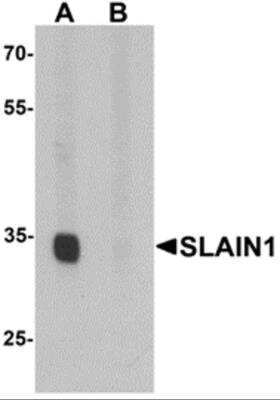 Western Blot SLAIN1 Antibody - BSA Free