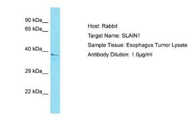 Western Blot: SLAIN1 Antibody [NBP2-82344] - Host: Rabbit. Target Name: SLAIN1. Sample Tissue: Human Esophagus Tumor. Antibody Dilution: 1ug/ml