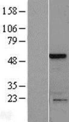 Western Blot SLAIN1 Overexpression Lysate