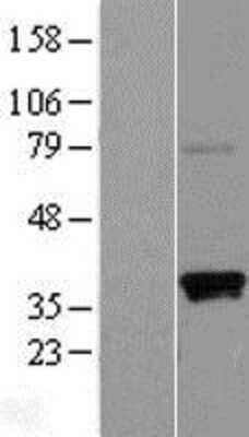 Western Blot CD2F-10/SLAMF9 Overexpression Lysate