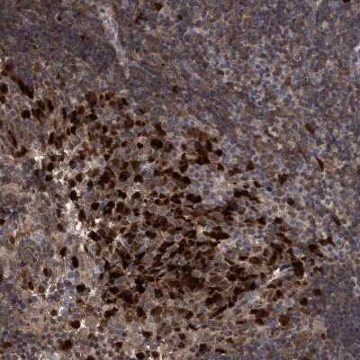 Immunohistochemistry-Paraffin: SLBP Antibody [NBP1-83290] - Staining of human tonsil shows strong nuclear/cytoplasmic positivity in germinal center cells.